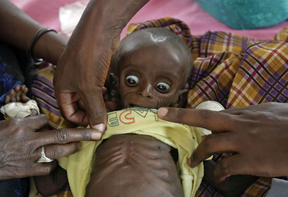 饥饿的东非-被世人遗忘的角落 东非旱情持续 大批儿童