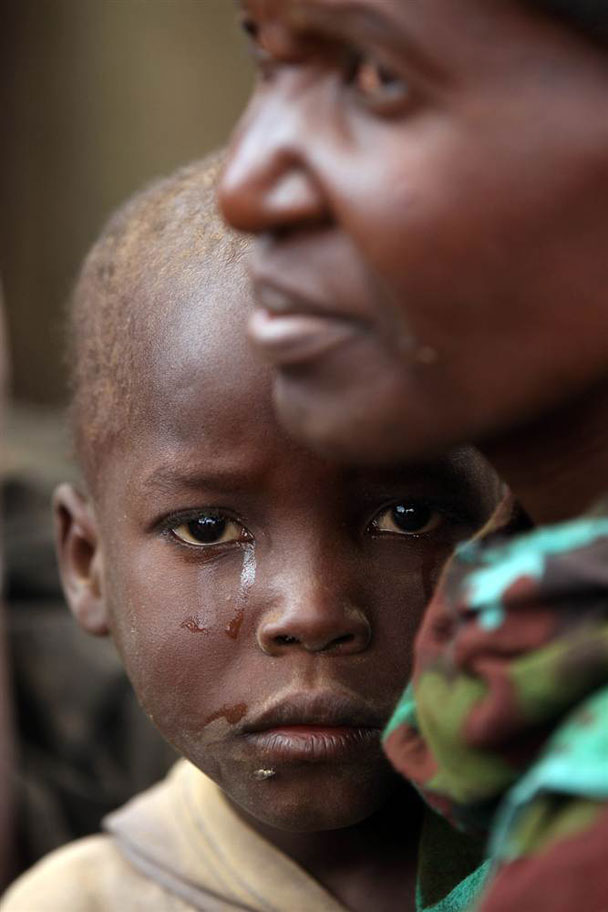 饥饿的东非-被世人遗忘的角落 东非旱情持续 大批儿童
